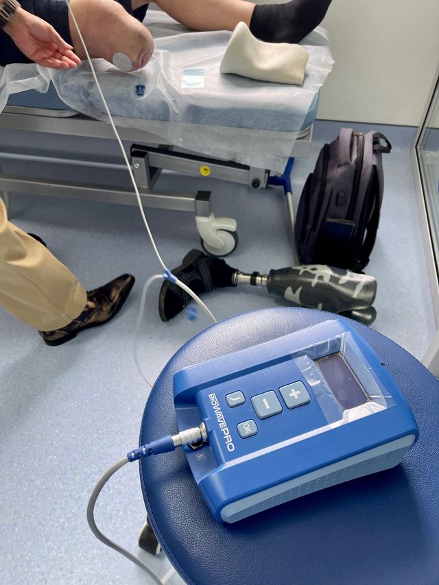 3eGImSIw | Stroud company delivers life-changing pain relief to Ukrainian war amputees